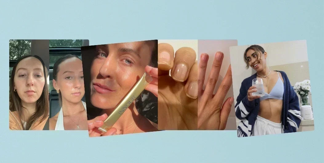 Do Inner Beauty Supplements Really Improve Your Skin?