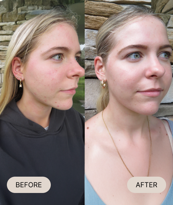 Before and after comparison of a woman's face with a stone wall background.