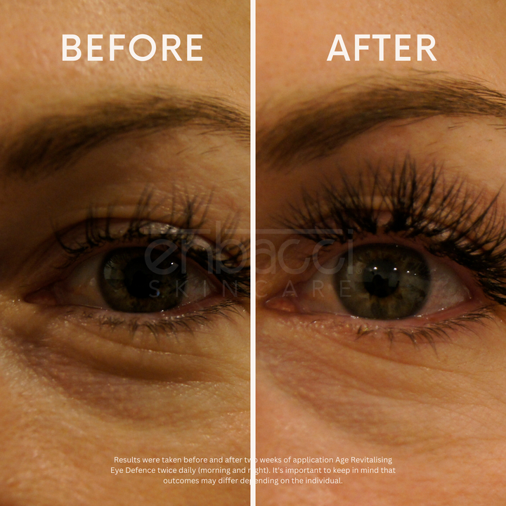 Age Revitalising Eye Defence