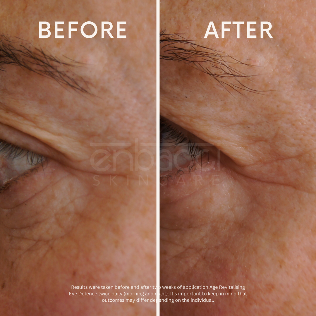 Age Revitalising Eye Defence