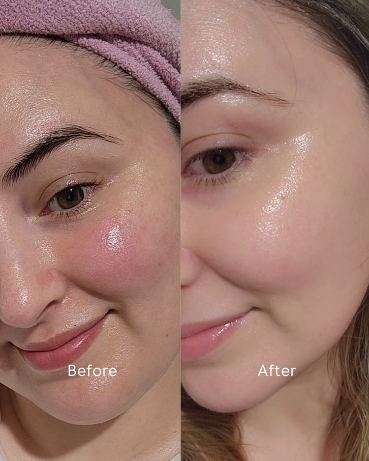 biobod Replenishing Hydra-Soothe Serum 50ml