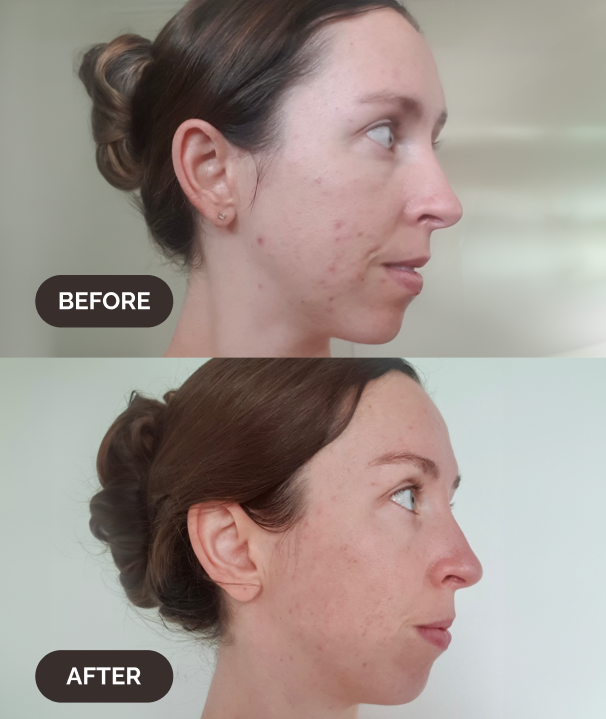 Plant-based retinol alternative serum for sensitive skin featuring Bakuchiol and calming botanical extracts.