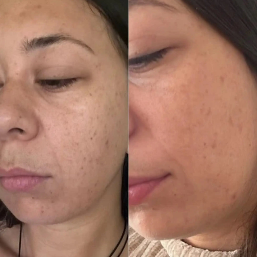 Before and after comparison of a woman's face with visible skin texture changes. Australian skincare products