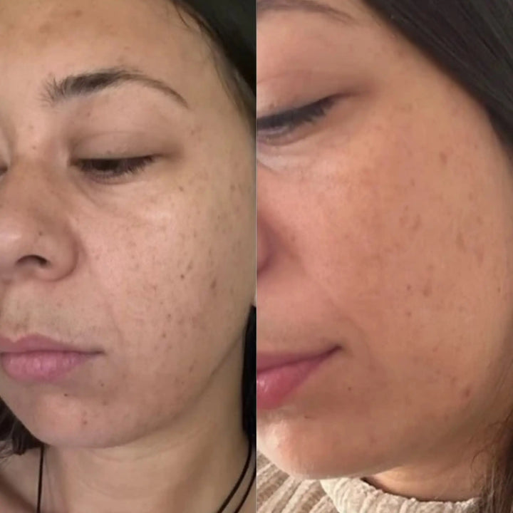 Before and after comparison of a woman's face with visible skin texture changes. Australian skincare products
