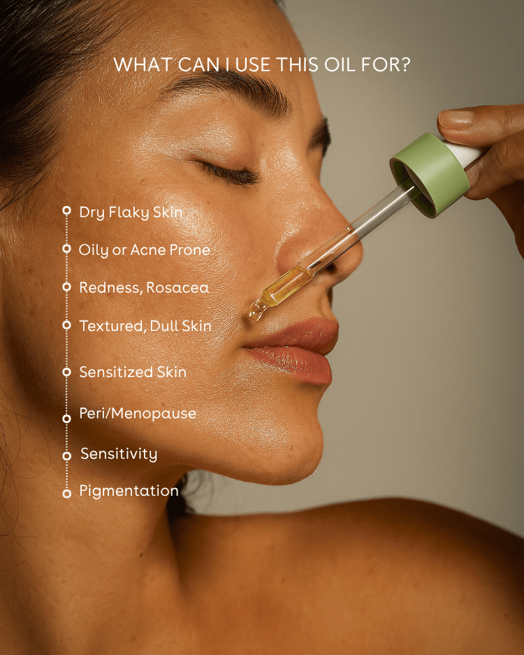 Woman applying face oil for acne prone skin to her face with a dropper, text overlay about skin conditions.