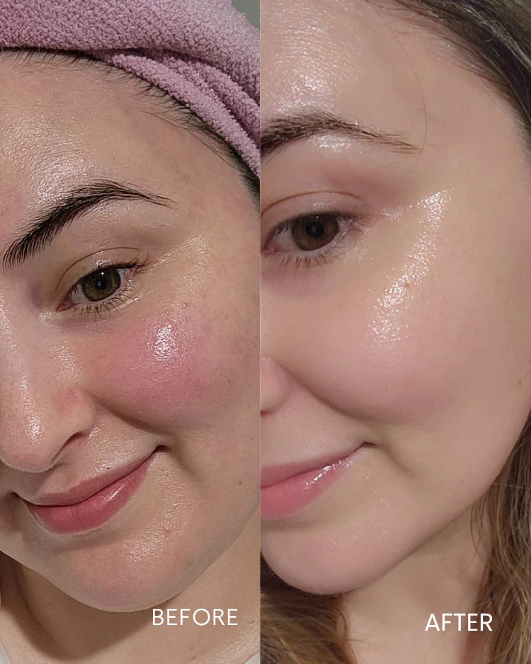 Biobod Replenishing Hydra-Soothe Serum, showing visibly calmer, more hydrated and radiant skin with reduced redness and improved skin barrier appearance.