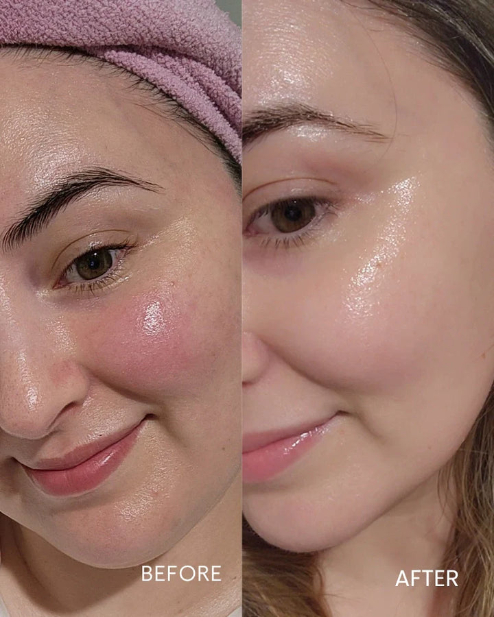 Biobod Replenishing Hydra-Soothe Serum, showing visibly calmer, more hydrated and radiant skin with reduced redness and improved skin barrier appearance.