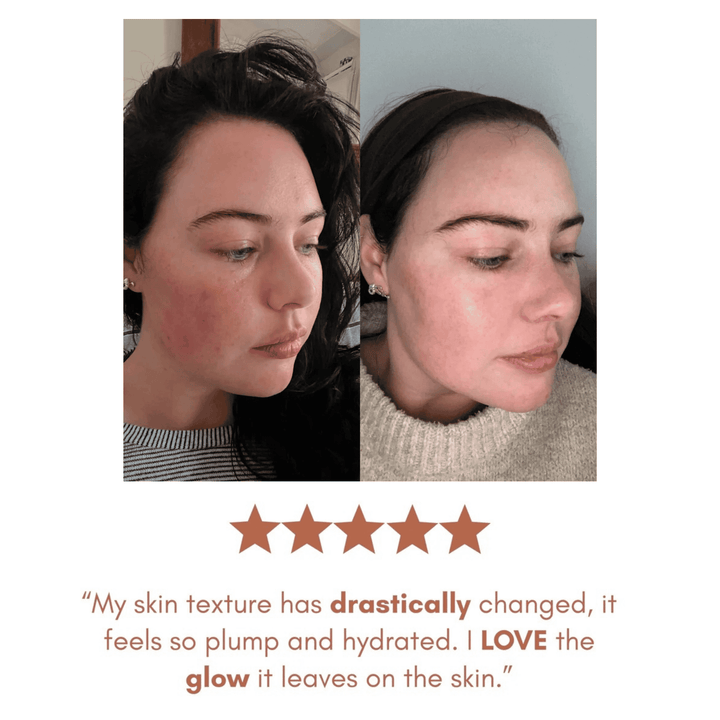 Before and after comparison of a woman's face with text about skin texture change.
