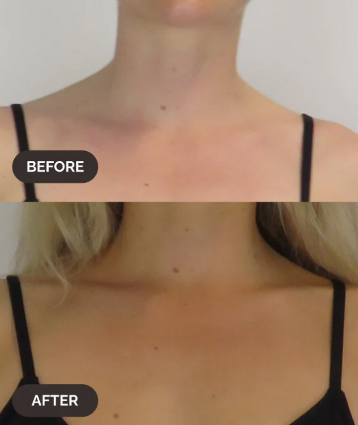 Before and after results on chest and neck using LAMAV Glow on the Go Self Tan Mist.