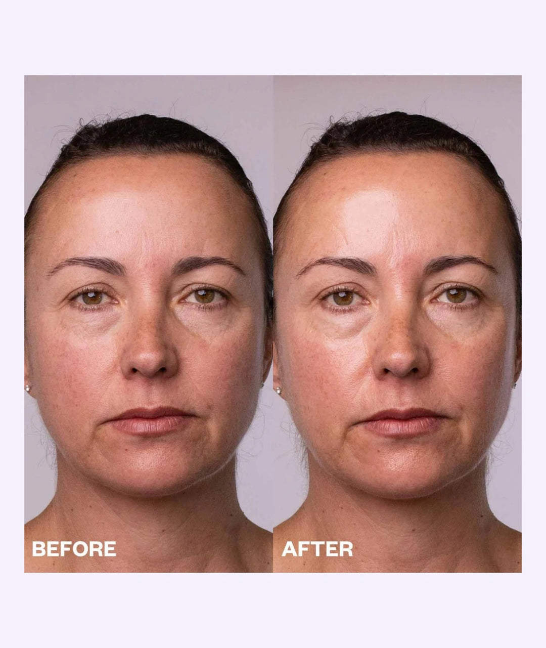 Before and after using Wrinkles Schminkles Polishing Peel Pads for brighter smoother skin